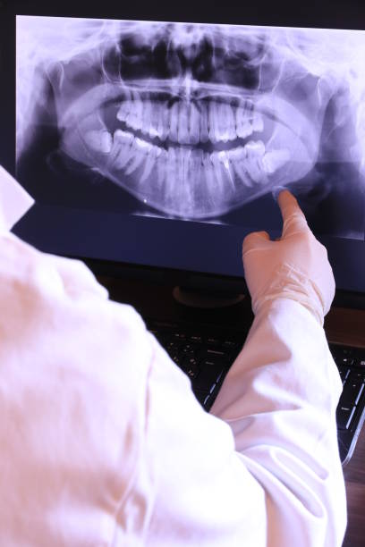 Best Emergency Tooth Extraction in Eton, GA